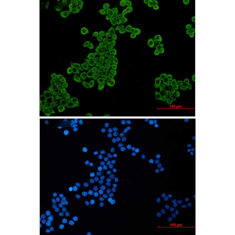 Rabbit Monoclonal Antibody to Elongation factor 2
