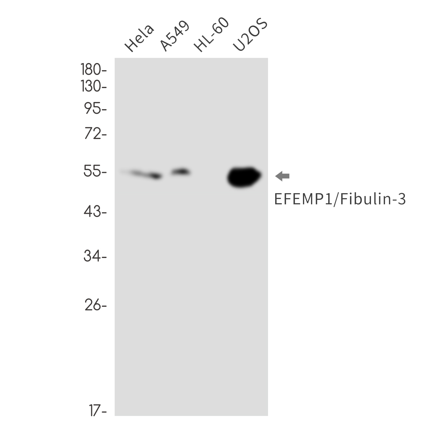 EFEMP1