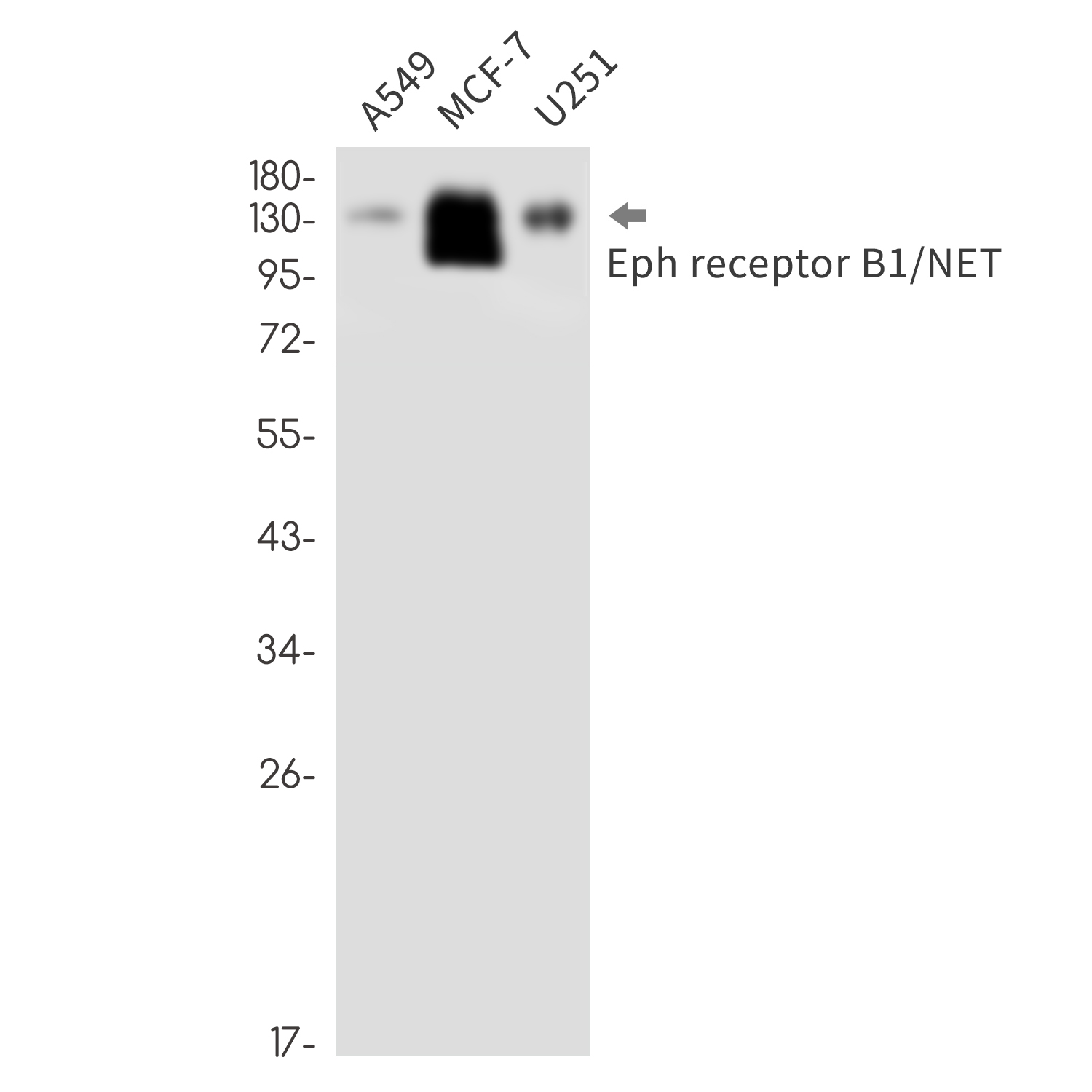 Ephrin Receptor B1