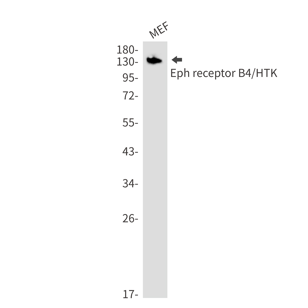 Ephrin Receptor B4