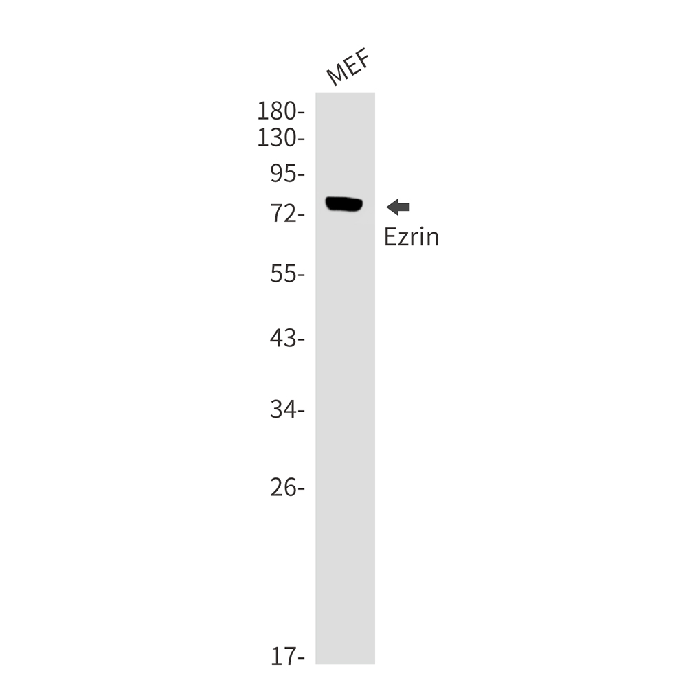 Ezrin