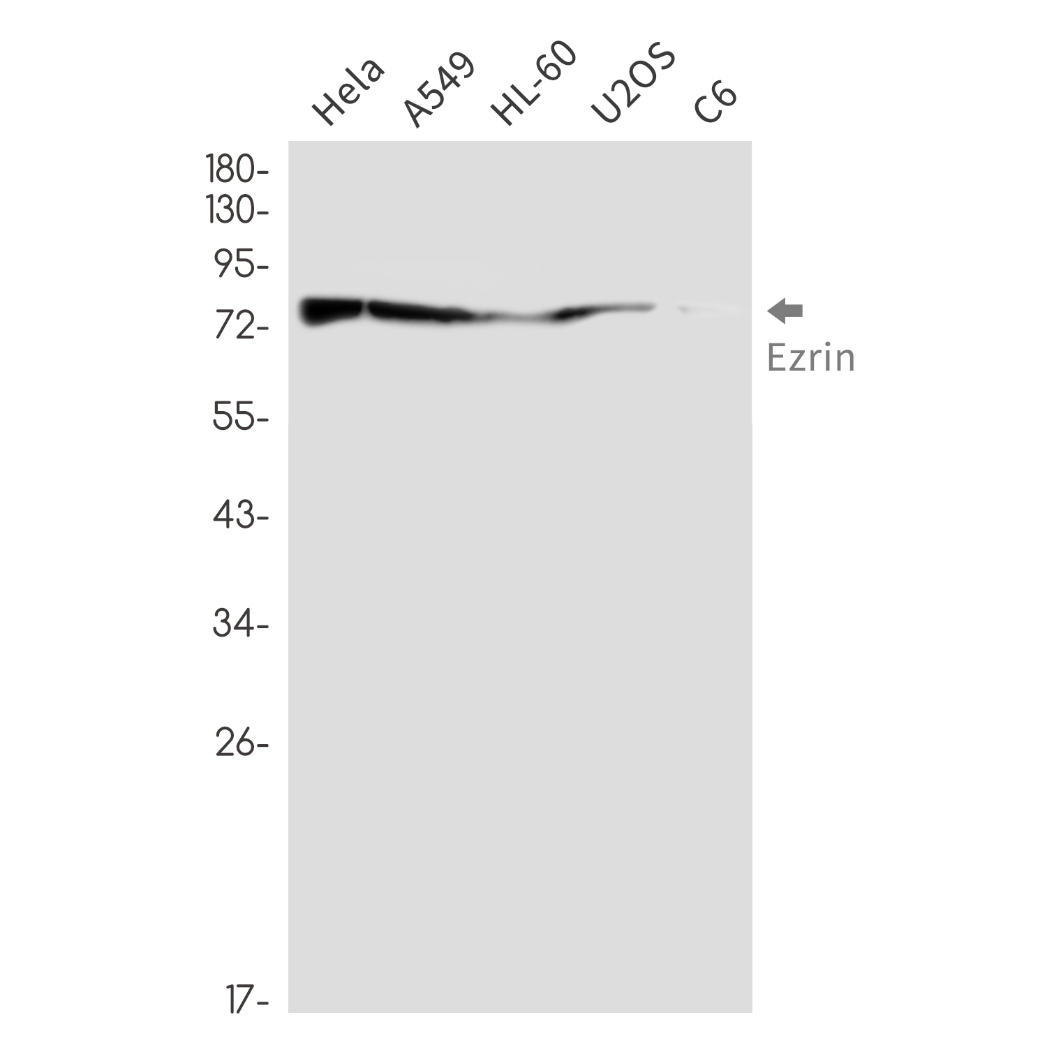 Rabbit Monoclonal Antibody to Ezrin