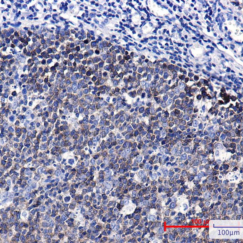 Rabbit Monoclonal Antibody to Ezrin