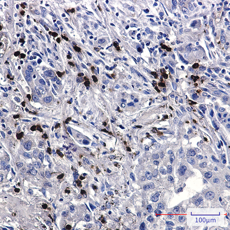 Rabbit Monoclonal Antibody to FE65