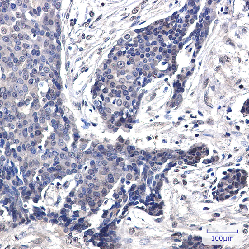 Rabbit Monoclonal Antibody to FHL1