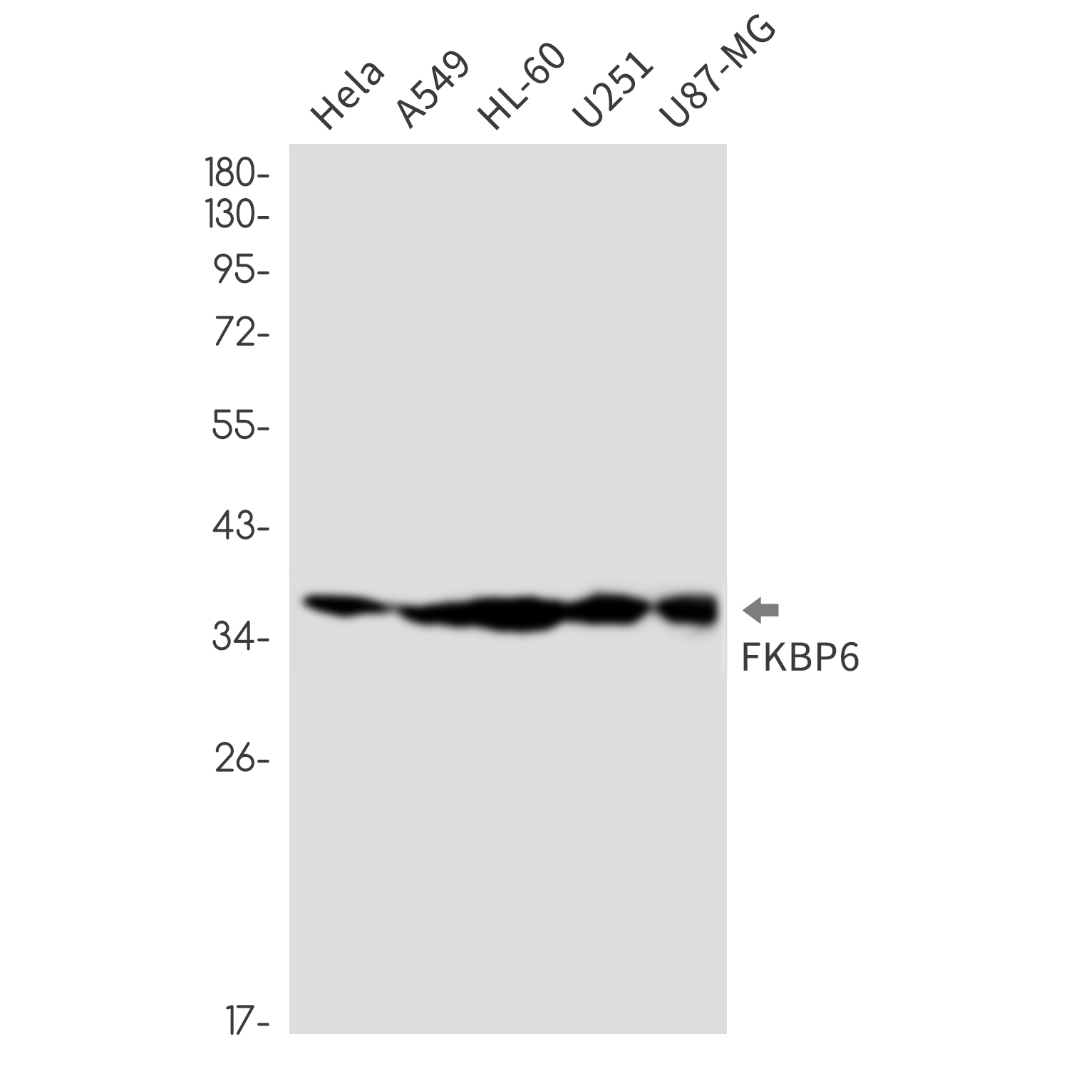 Rabbit Monoclonal Antibody to FKBP6