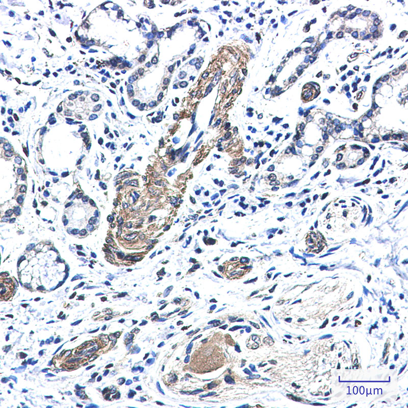 Rabbit Monoclonal Antibody to FXR1