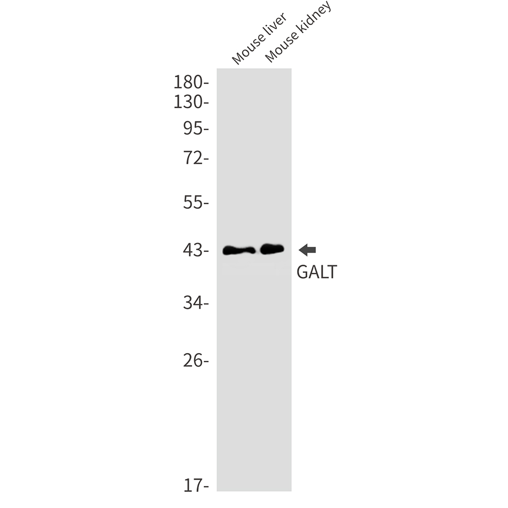 GALT