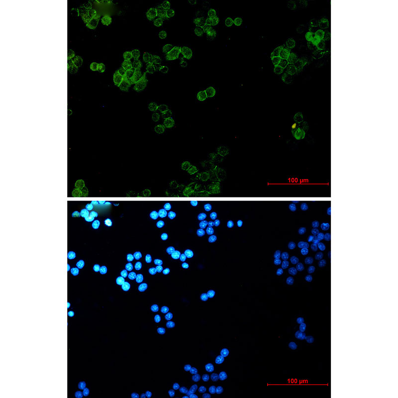 Rabbit Monoclonal Antibody to gamma Catenin