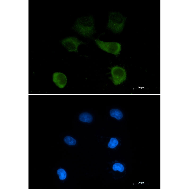 Rabbit Monoclonal Antibody to gamma Tubulin