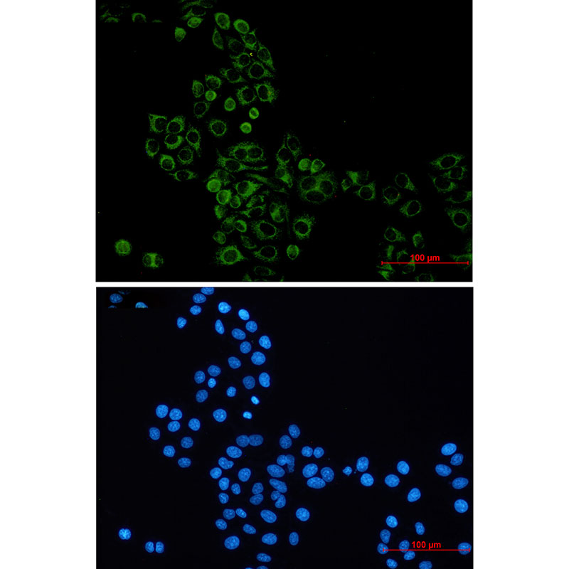 Rabbit Monoclonal Antibody to GBP1