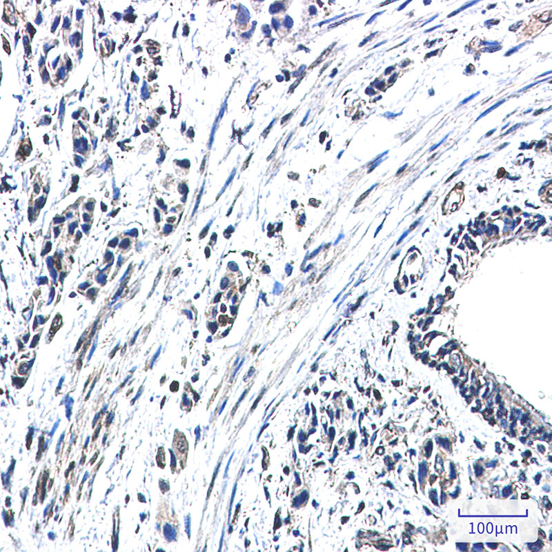 Rabbit Monoclonal Antibody to GBP1