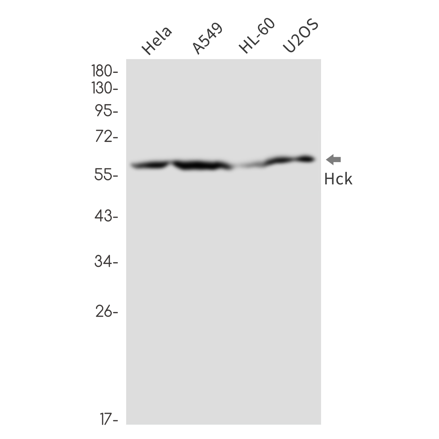 Tyrosine Protein Kinase HCK