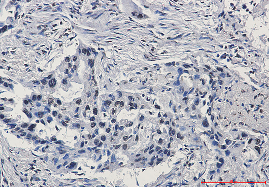 Rabbit Monoclonal Antibody to HIF1 beta