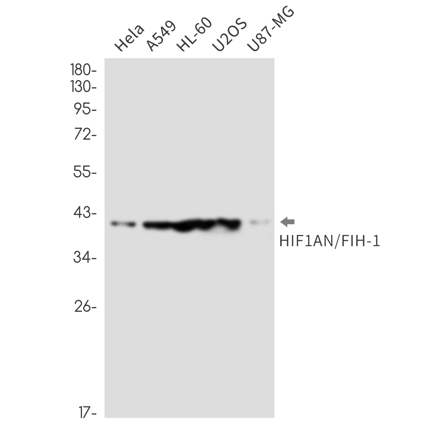 HIF1AN