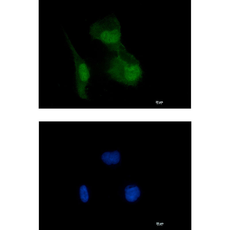 Rabbit Monoclonal Antibody to HIF1AN
