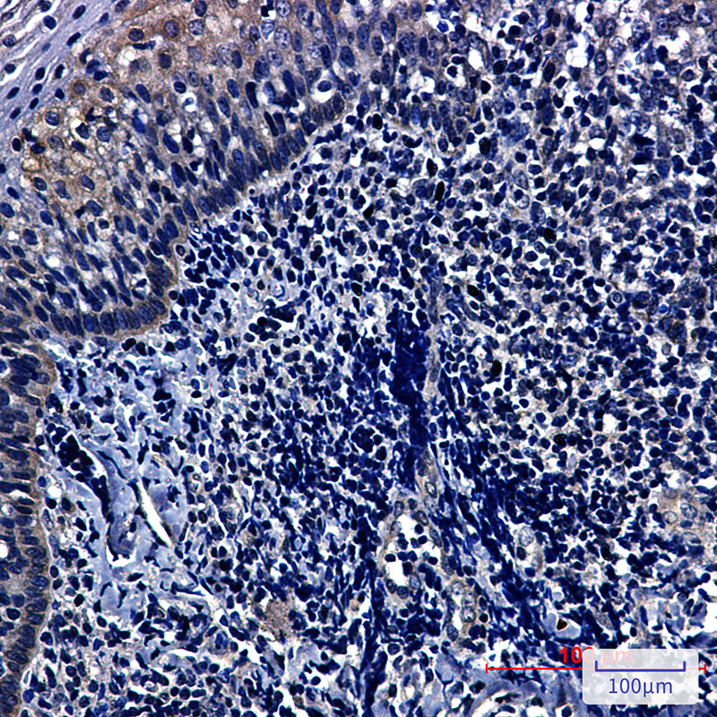 Rabbit Monoclonal Antibody to HIF1AN