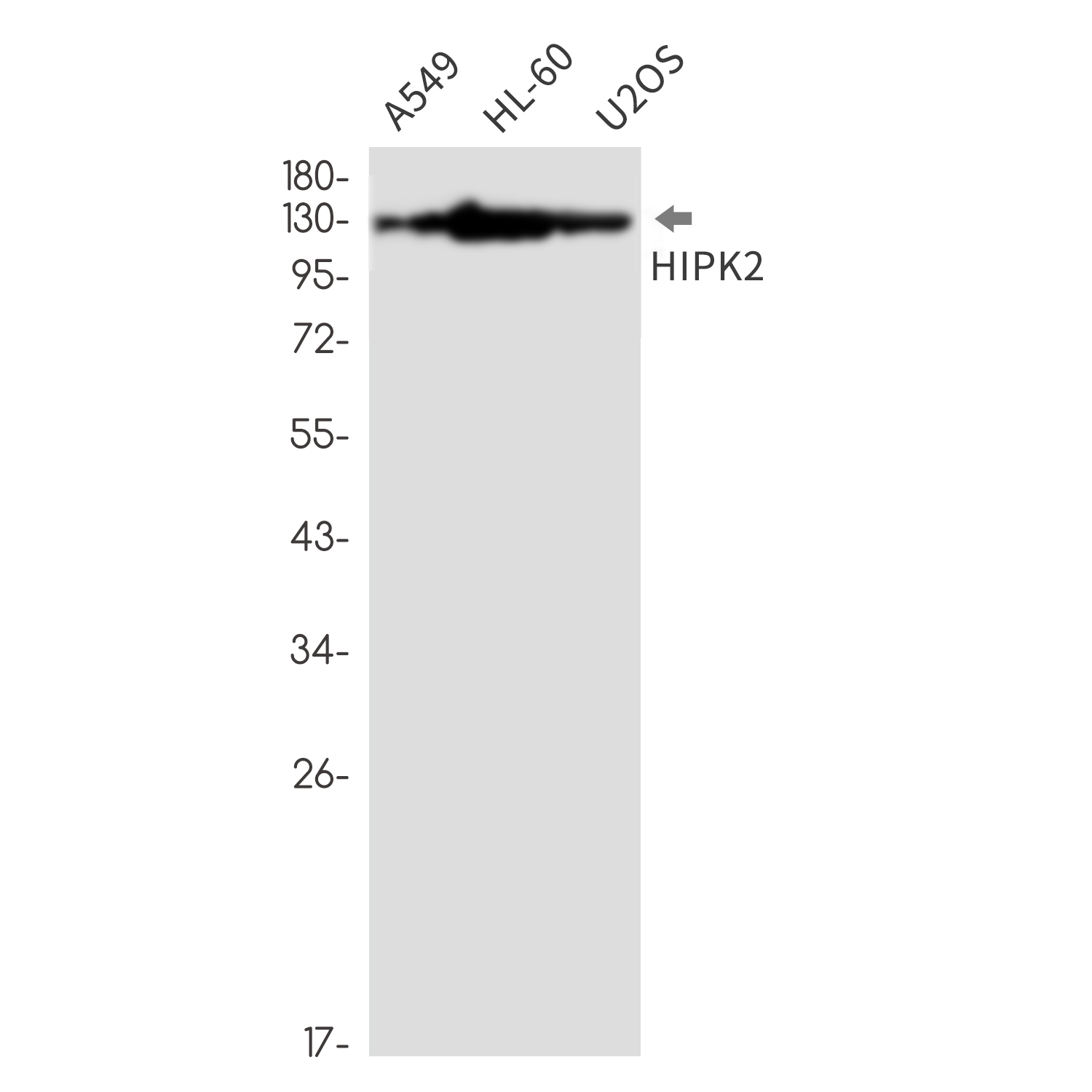 HIPK2