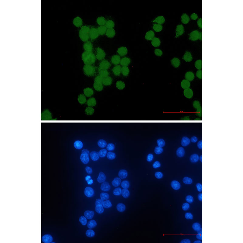 Rabbit Monoclonal Antibody to HIPK2