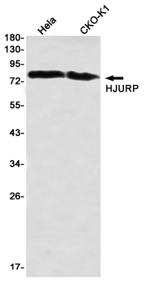 HJURP
