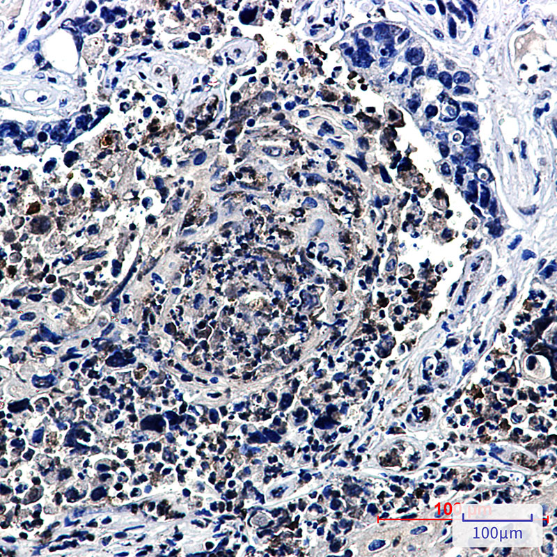 Rabbit Monoclonal Antibody to HJURP