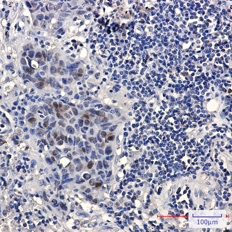 Rabbit Monoclonal Antibody to HMG4
