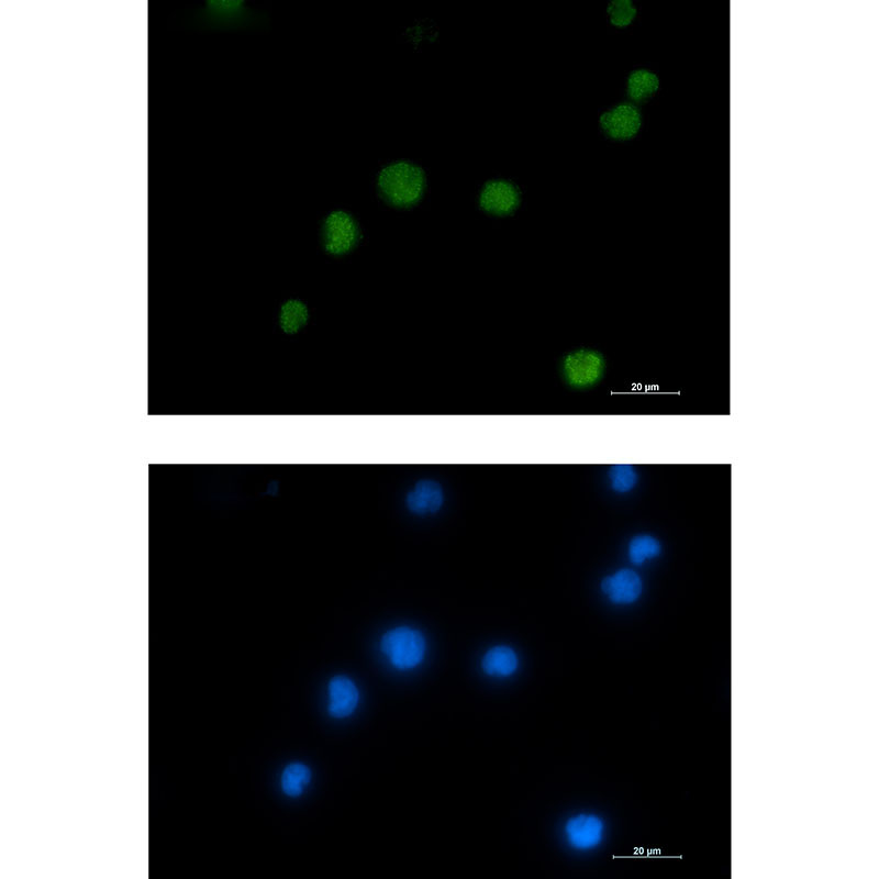 Rabbit Monoclonal Antibody to HMGB2