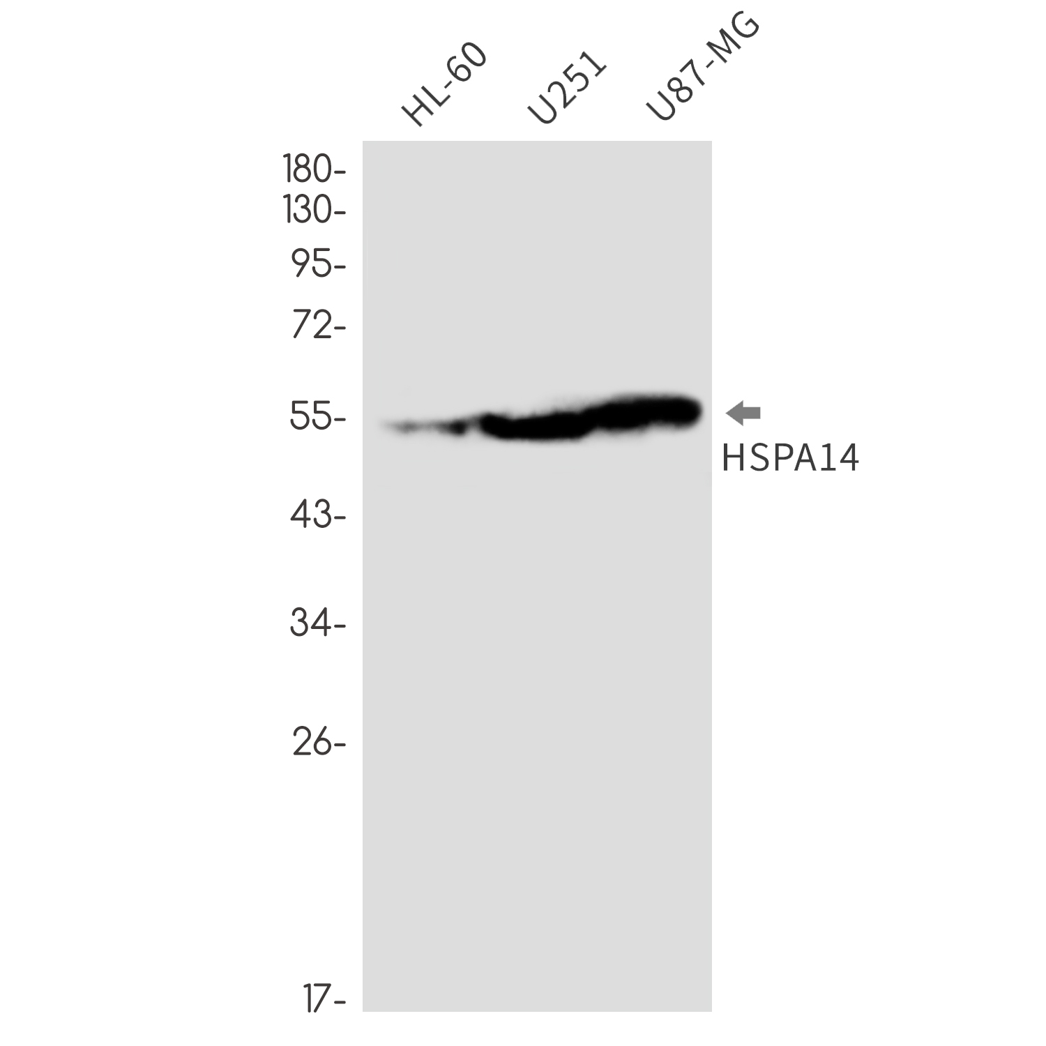 Rabbit Monoclonal Antibody to HspA14