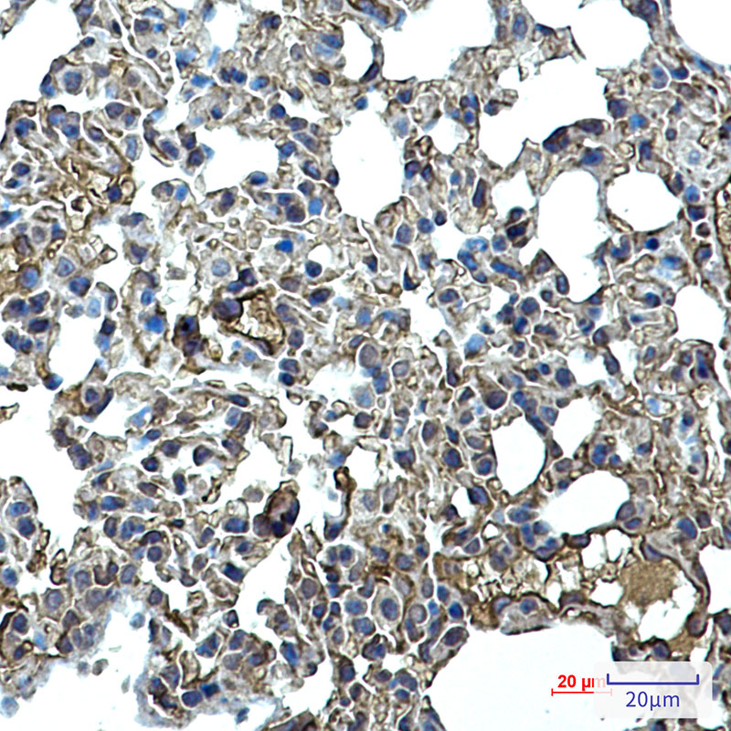 Rabbit Monoclonal Antibody to ICAM2