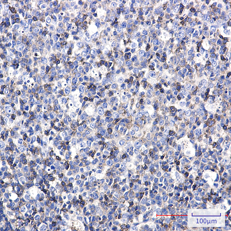 Rabbit Monoclonal Antibody to ICAM3