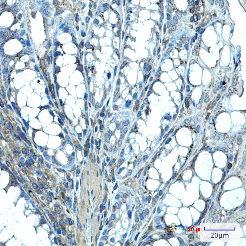 Rabbit Monoclonal Antibody to Ihh