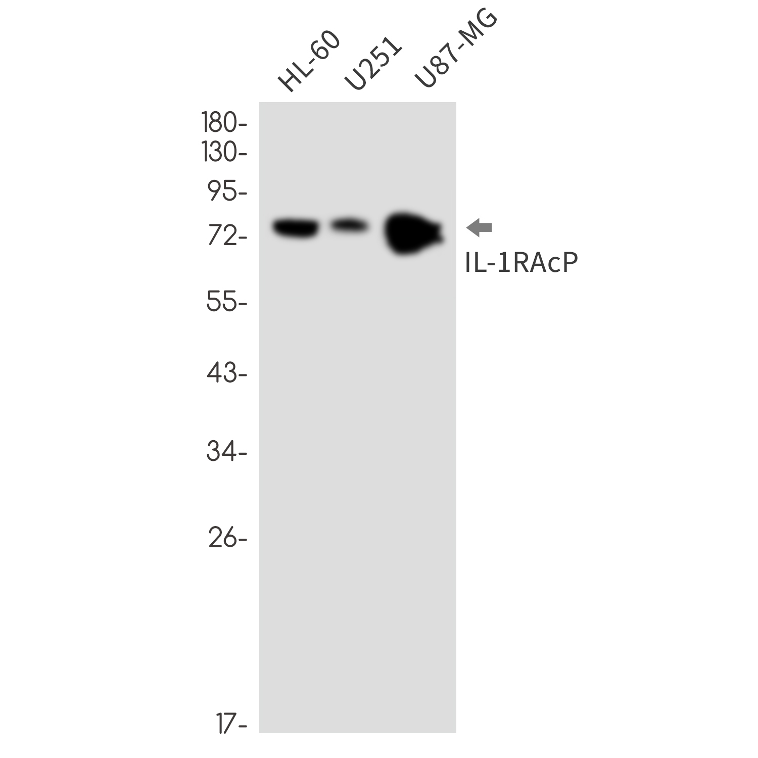 IL-1 Receptor Accessory Protein