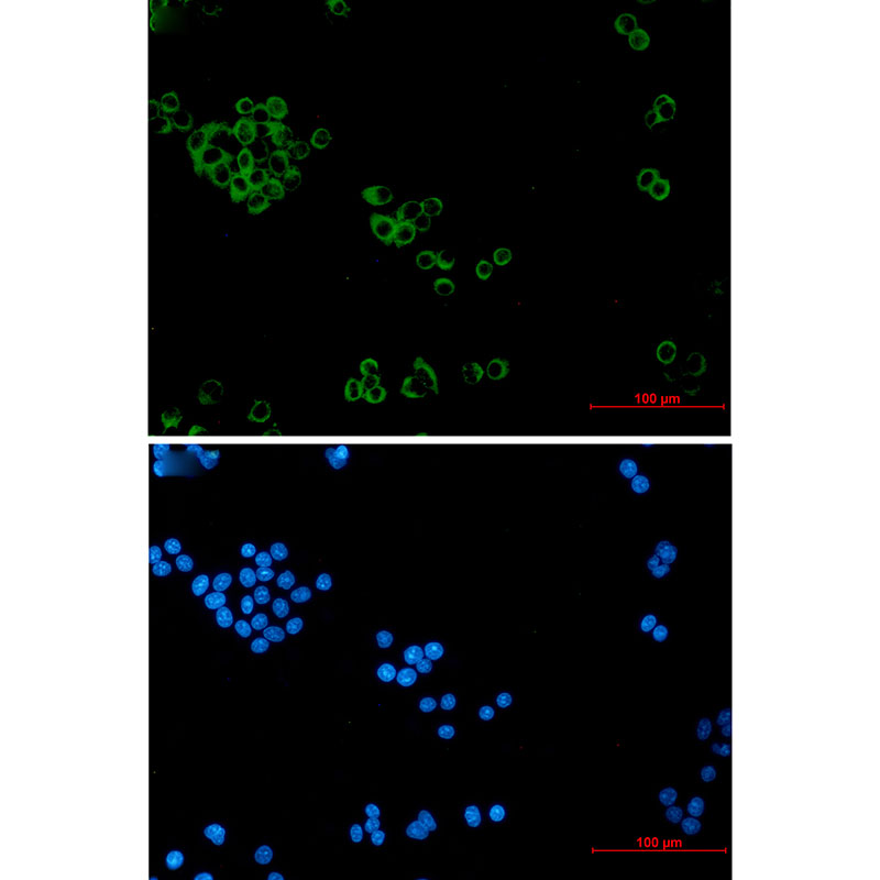 Rabbit Monoclonal Antibody to IMPDH2