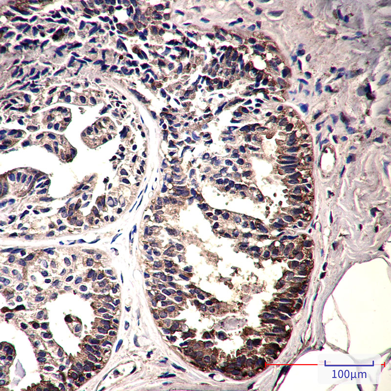 Rabbit Monoclonal Antibody to IMPDH2