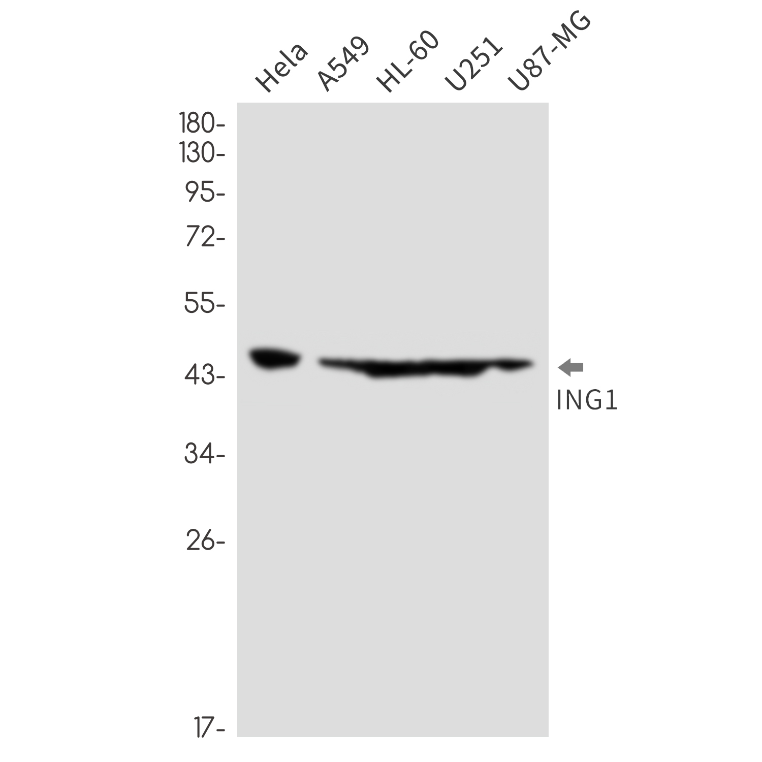 Rabbit Monoclonal Antibody to ING1