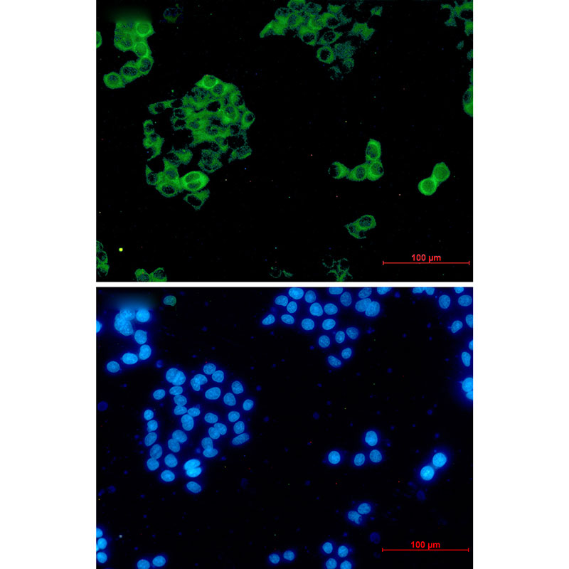 Rabbit Monoclonal Antibody to Insulin Degrading Enzyme