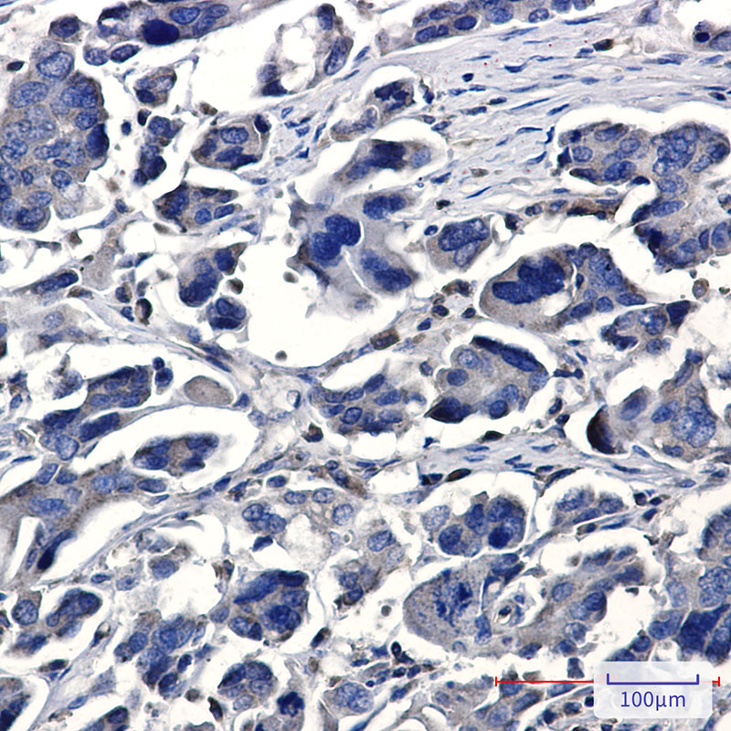 Rabbit Monoclonal Antibody to IQGAP2