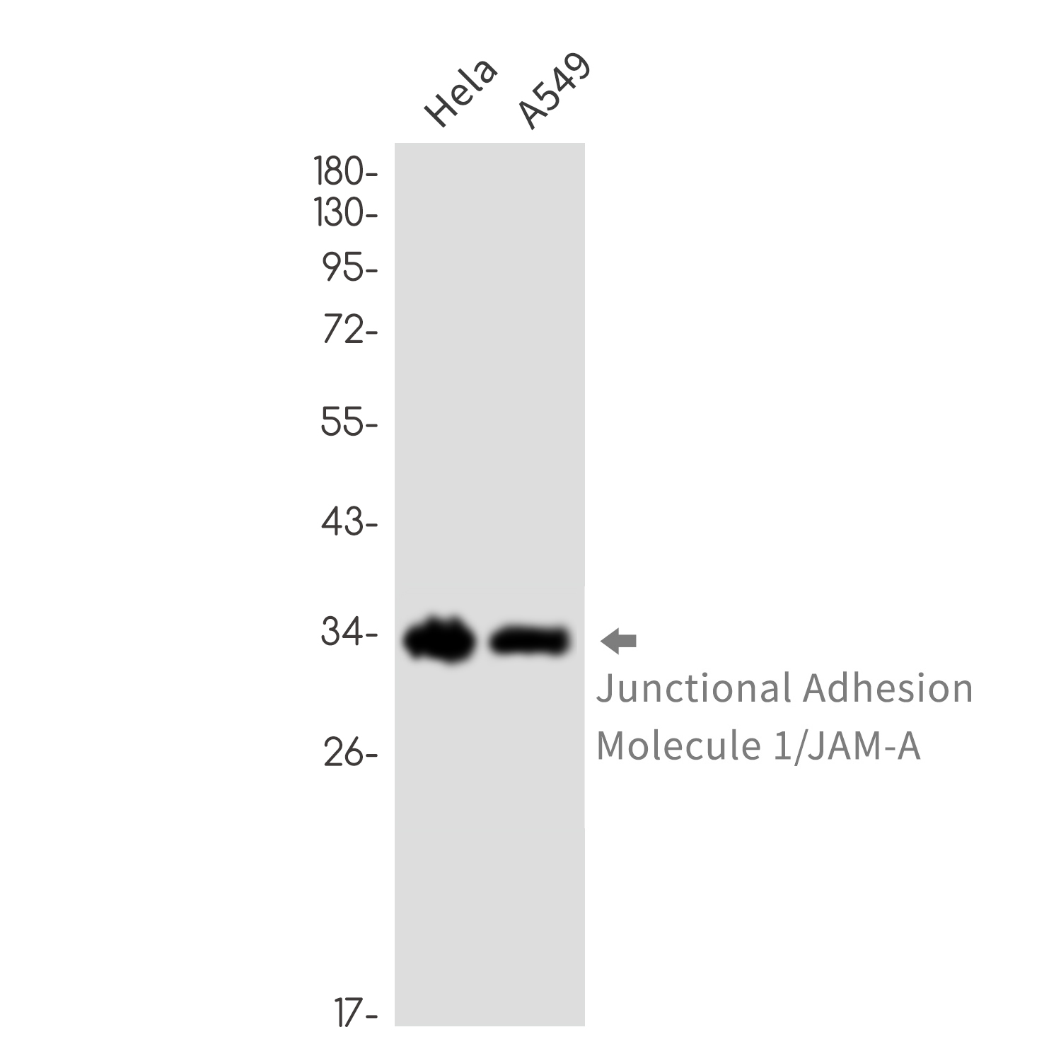 Junctional Adhesion Molecule 1
