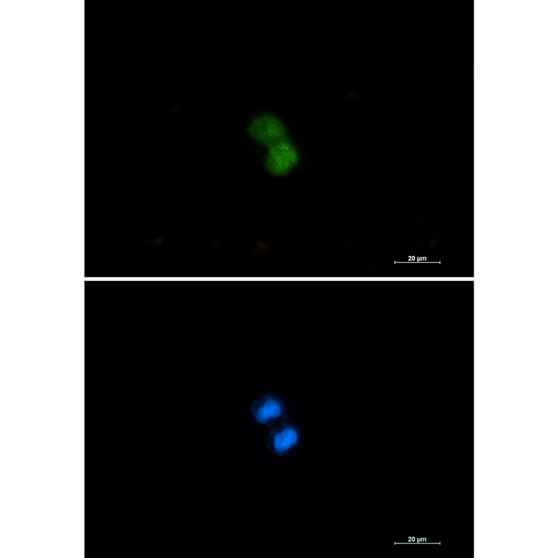 Rabbit Monoclonal Antibody to KAT7