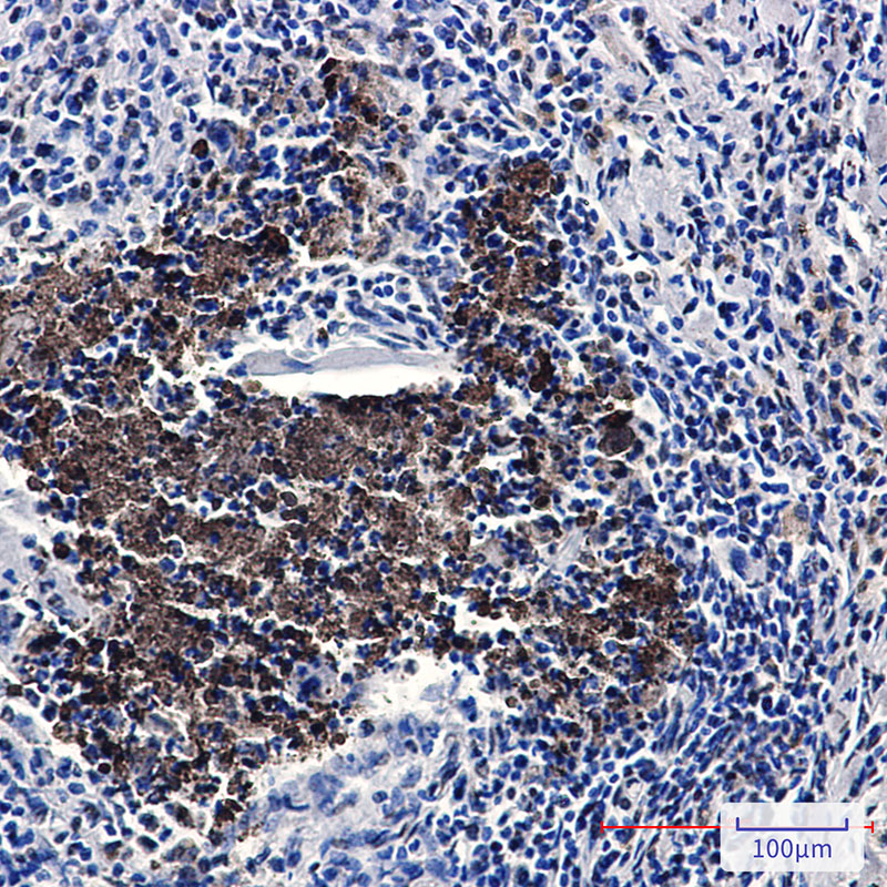 Rabbit Monoclonal Antibody to KAT7