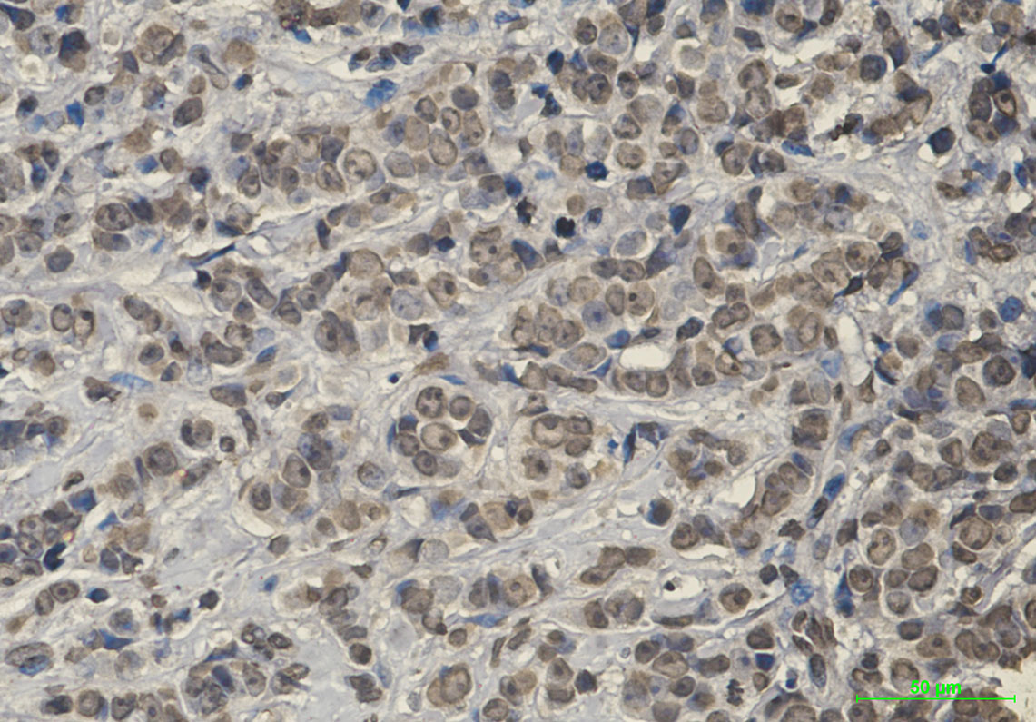 Rabbit Monoclonal Antibody to Keap1