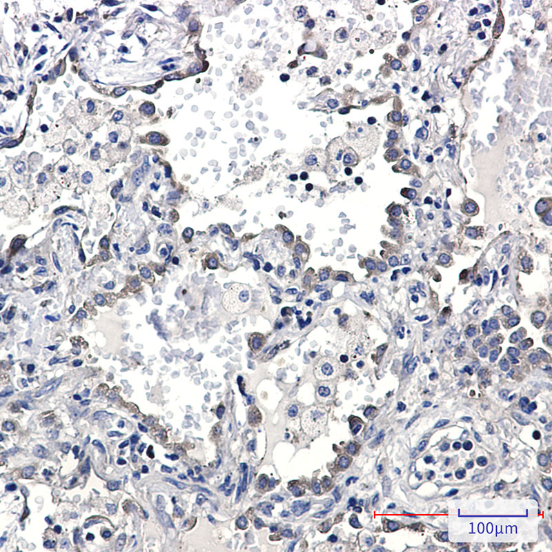 Rabbit Monoclonal Antibody to KIFAP3