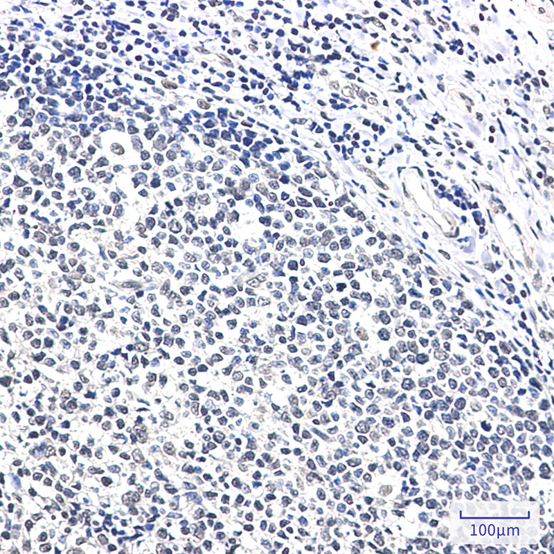 Rabbit Monoclonal Antibody to Ku70