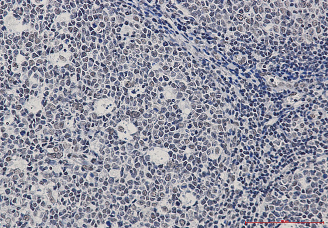 Rabbit Monoclonal Antibody to Ku70