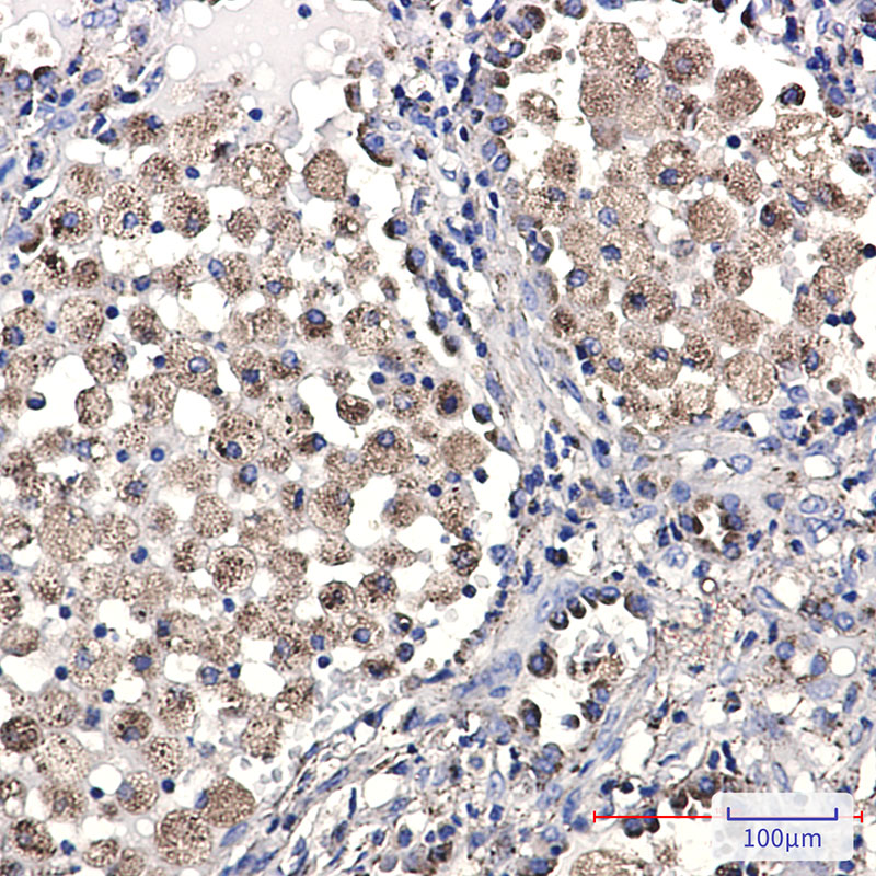 Rabbit Monoclonal Antibody to LAMP2