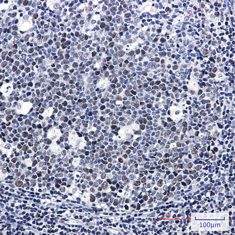 Rabbit Monoclonal Antibody to LIG1