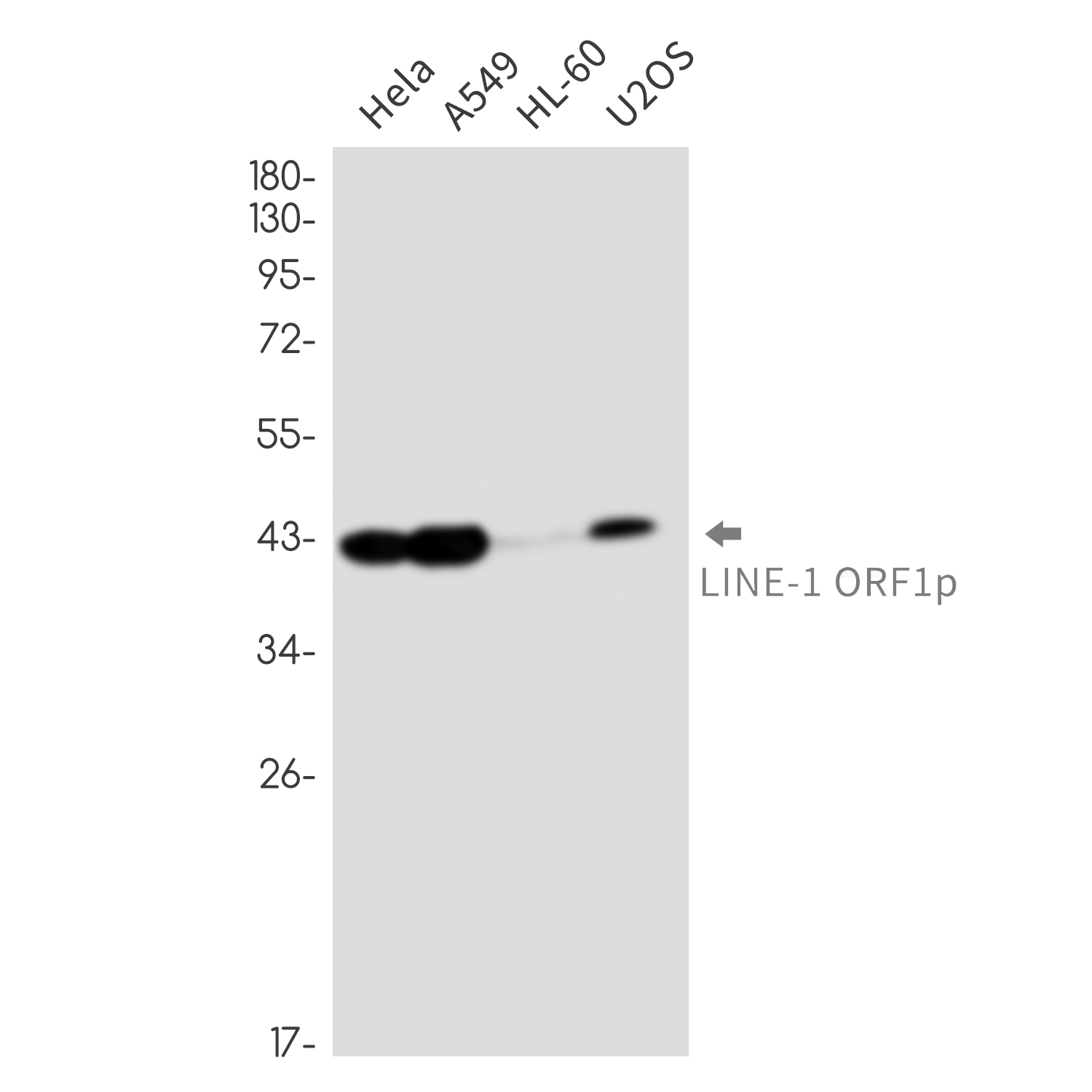 LINE 1 ORF1p