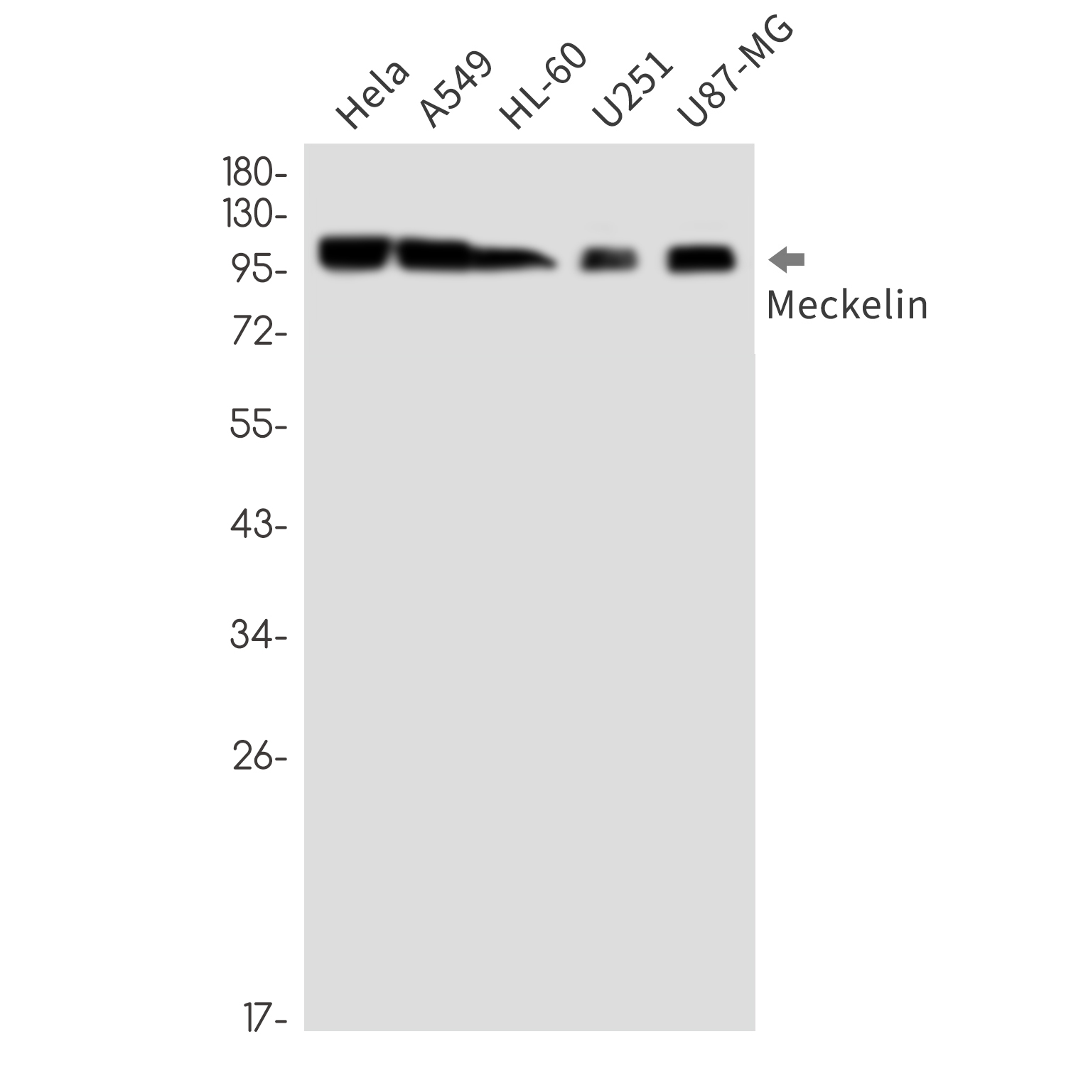 Meckelin