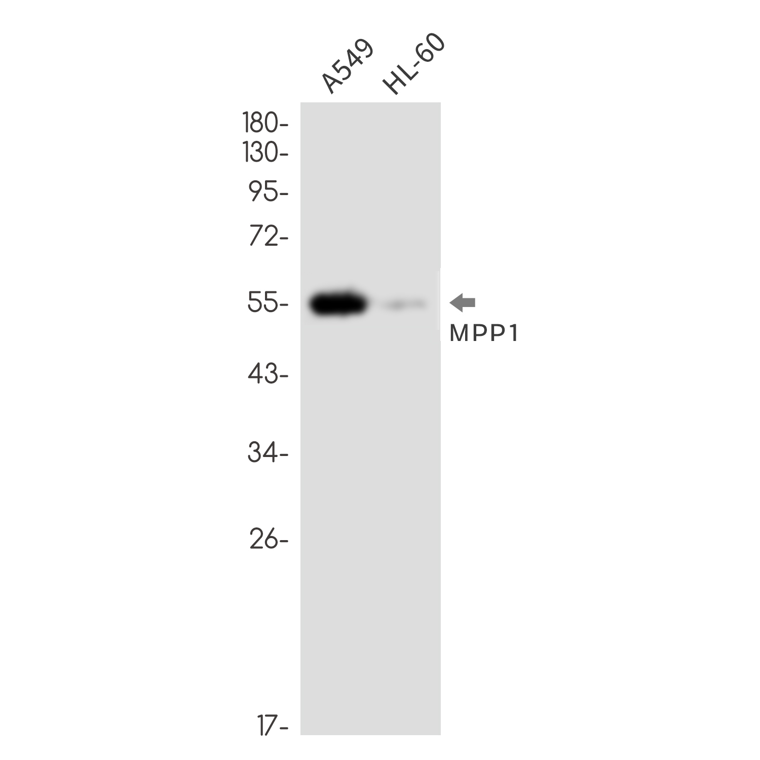 MPP1