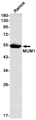Interferon Regulatory Factor 4